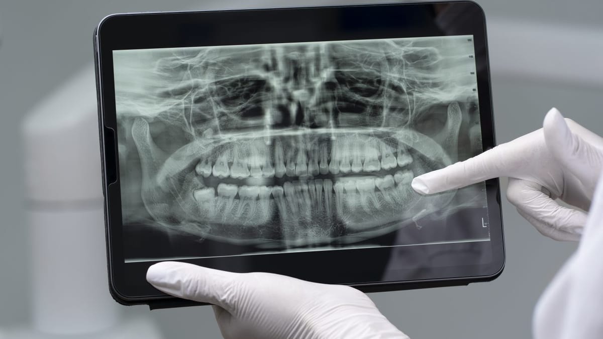 Atención de endodoncia en la clínica